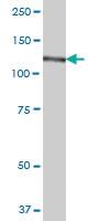 Anti-CC2D1A Mouse Polyclonal Antibody