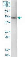 Anti-FOXP3 Polyclonal Antibody Pair