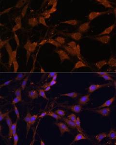 Immunofluorescence analysis of C6 cells using Anti-Bcl-2 Antibody (A308149) at a dilution of 1:100. DAPI was used to stain the cell nuclei (blue)