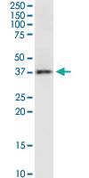 Anti-RAMP3 Mouse Monoclonal Antibody [clone: 1C11]