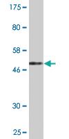 Anti-PMVK Mouse Monoclonal Antibody [clone: 2B8]