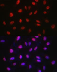 Immunofluorescence analysis of U2OS cells using Anti-WDR46 Antibody (A305665) at a dilution of 1:50 (40x lens). DAPI was used to stain the cell nuclei (blue)