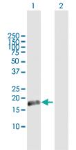 Anti-CETN1 Rabbit Polyclonal Antibody