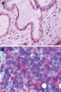 Anti-MME Mouse Monoclonal Antibody [clone: 2A1H5E1]