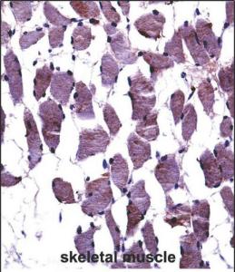 Anti-NTRK1 Rabbit Polyclonal Antibody