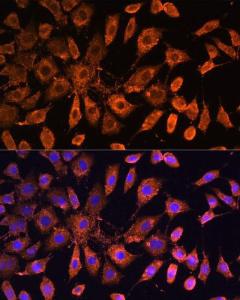 Immunofluorescence analysis of L929 cells using Anti-Bcl-2 Antibody (A308149) at a dilution of 1:100. DAPI was used to stain the cell nuclei (blue)