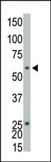 Anti-ETNK1 Rabbit Polyclonal Antibody