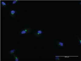 Anti-ACBD3 Mouse Monoclonal Antibody [clone: 2H2]