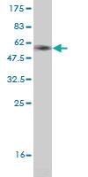 Anti-CRYGD Mouse Monoclonal Antibody [clone: 4E12]