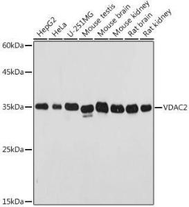 Western blot analysis of extracts of various cell lines, using Anti-VDAC2 Antibody (A307060) at 1:500 dilution