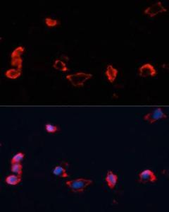 Immunofluorescence analysis of HeLa cells using Anti-Caveolin 1 Antibody (A12510) at a dilution of 1:100. DAPI was used to stain the cell nuclei (blue).