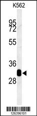 Anti-RDH16 Rabbit Polyclonal Antibody