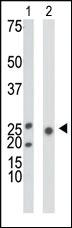 Anti-Ketohexokinase (KHK) Rabbit Polyclonal Antibody