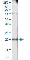 Anti-CETN1 Rabbit Polyclonal Antibody