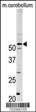 Anti-CDK14 Rabbit Polyclonal Antibody (APC (Allophycocyanin))