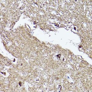 Immunohistochemistry analysis of paraffin-embedded human brain tissue using Anti-VDAC2 Antibody (A307060) at a dilution of 1:100 (40x lens). Perform high pressure antigen retrieval with 10 mM citrate buffer pH 6.0 before commencing with IHC staining protocol