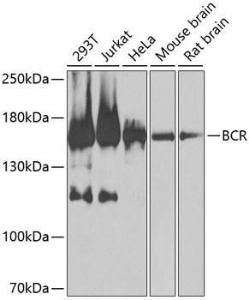 Western blot analysis of extracts of various cell lines, using Anti-Bcr Antibody (A12512) at 1:1,000 dilution. The secondary antibody was Goat Anti-Rabbit IgG H&L Antibody (HRP) at 1:10,000 dilution.