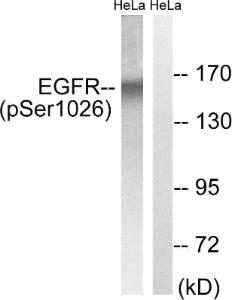 Anti-EGFR