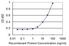 Anti-CLP1 Mouse Monoclonal Antibody [clone: 8D5]