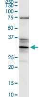 Anti-STX5 Mouse Monoclonal Antibody [clone: 5A6]