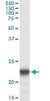 Anti-PMVK Antibody Pair