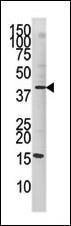 Anti-JUN Rabbit Polyclonal Antibody