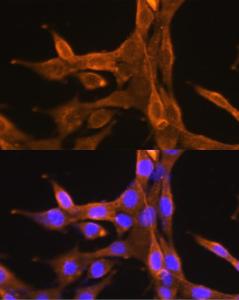 Immunofluorescence analysis of NIH/3T3 cells using Anti-Bcl-2 Antibody (A308149) at a dilution of 1:100 (40X lens). DAPI was used to stain the cell nuclei (blue)