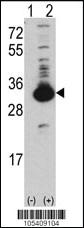 Anti-Ketohexokinase (KHK) Rabbit Polyclonal Antibody