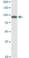 Anti-PLOD2 Rabbit Polyclonal Antibody