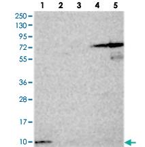 Anti-HIGD1A Rabbit Polyclonal Antibody