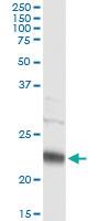 Anti-PMVK Antibody Pair