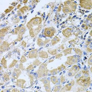 Immunohistochemistry analysis of paraffin-embedded human stomach using Anti-Bcr Antibody (A12512) at a dilution of 1:100 (40x lens). Perform microwave antigen retrieval with 10 mM PBS buffer pH 7.2 before commencing with IHC staining protocol.