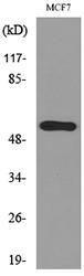 Western blot analysis of lysate from MCF7 cells using Anti-KRT14 Antibody