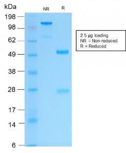 SDS-PAGE analysis of Anti-Cytokeratin 16 Antibody [KRT16/2043R] under non-reduced and reduced conditions; showing intact IgG and intact heavy and light chains, respectively. SDS-PAGE analysis confirms the integrity and purity of the antibody.