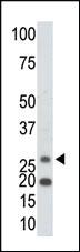 Anti-Ketohexokinase (KHK) Rabbit Polyclonal Antibody