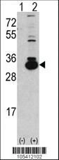 Anti-Ketohexokinase (KHK) Rabbit Polyclonal Antibody