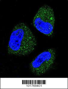 Anti-HSPA13 Rabbit Polyclonal Antibody (AP (Alkaline Phosphatase))