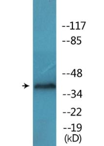 Antibody anti-EFNB1 phospho TYR317 100 µg