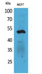 Western blot analysis of MCF7 cells using Anti-KRT14 Antibody