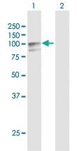 Anti-PLOD2 Rabbit Polyclonal Antibody