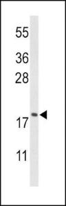 Anti-CFL1 Rabbit Polyclonal Antibody (FITC (Fluorescein Isothiocyanate))