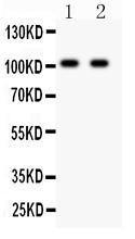 Anti-GRIA4 Polyclonal Antibody