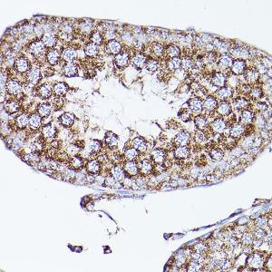 Immunohistochemistry analysis of paraffin-embedded mouse testis using Anti-VDAC2 Antibody (A307060) at a dilution of 1:100 (40x lens). Perform high pressure antigen retrieval with 10 mM citrate buffer pH 6.0 before commencing with IHC staining protocol