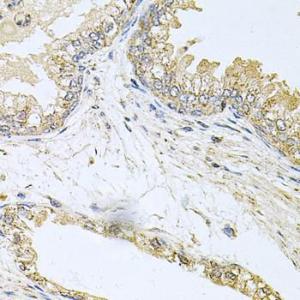 Immunohistochemistry analysis of paraffin-embedded human prostate using Anti-Bcr Antibody (A12512) at a dilution of 1:100 (40x lens). Perform microwave antigen retrieval with 10 mM PBS buffer pH 7.2 before commencing with IHC staining protocol.