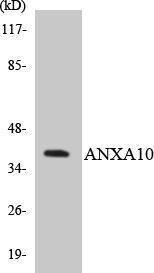 Western blot analysis of the lysates from Jurkat cells using Anti-ANXA10 Antibody