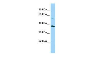 Anti-NDUFAF5 Rabbit Polyclonal Antibody