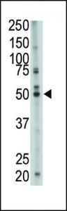 Anti-FDFT1 Rabbit Polyclonal Antibody (PE (Phycoerythrin))