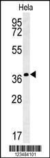 Anti-IL24 Rabbit Polyclonal Antibody