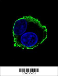 Anti-MMP14 Mouse Monoclonal Antibody [clone: 133CT15.10.5.1]