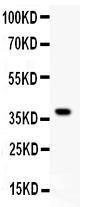 Anti-GRIK1 Polyclonal Antibody